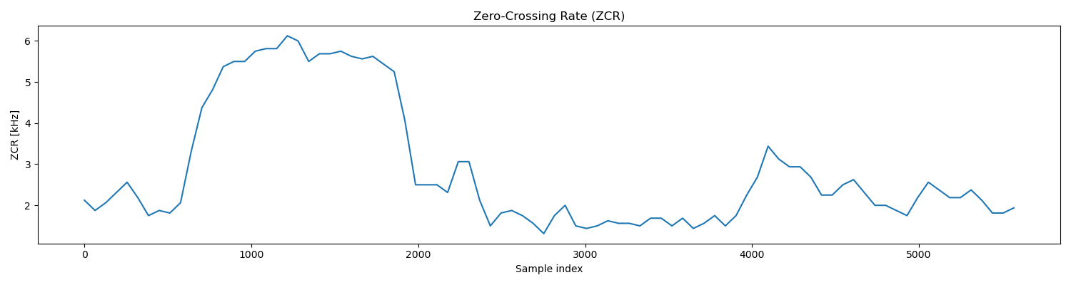 /posts/note/dsp/mfcc/assets/shop/zcr.webp